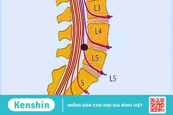 Đau thần kinh tọa uống thuốc gì? 8 thuốc trị hiệu quả theo đơn bác sĩ