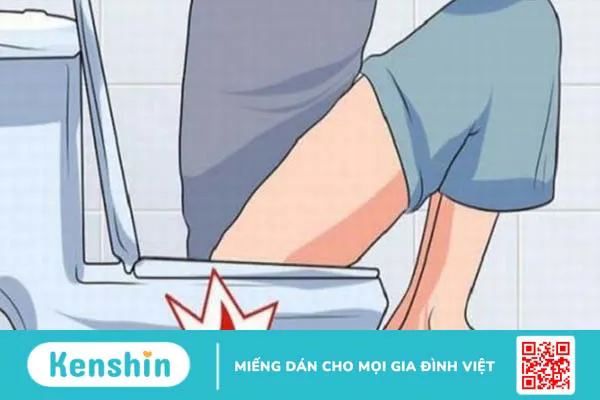 Đi cầu ra máu có thể là biểu hiện của 13 bệnh gì? Xem ngay