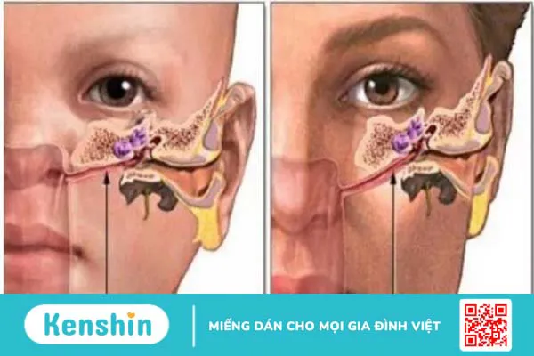 Mối liên quan giữa tai mũi họng có thể bạn chưa biết