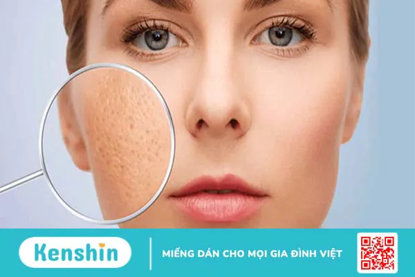 Những lợi ích tuyệt vời từ giấm táo đối với làm đẹp và chăm sóc cơ thể