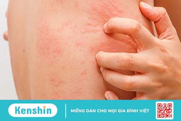 Những người không nên uống nước dừa