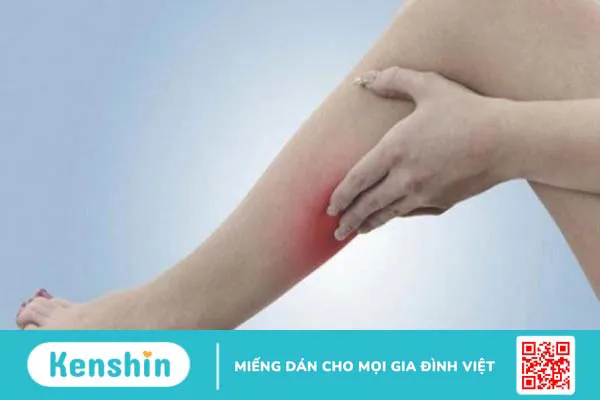 Suy giãn tĩnh mạch có nguy hiểm không?