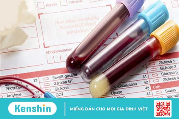 Tăng phosphat máu là gì? Triệu chứng và cách điều trị