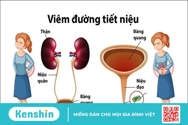 Viêm đường tiết niệu có tự khỏi không? Bao lâu khỏi và cách điều trị